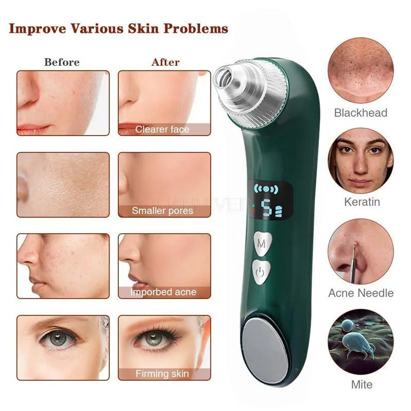 Heating Pore Cleanser